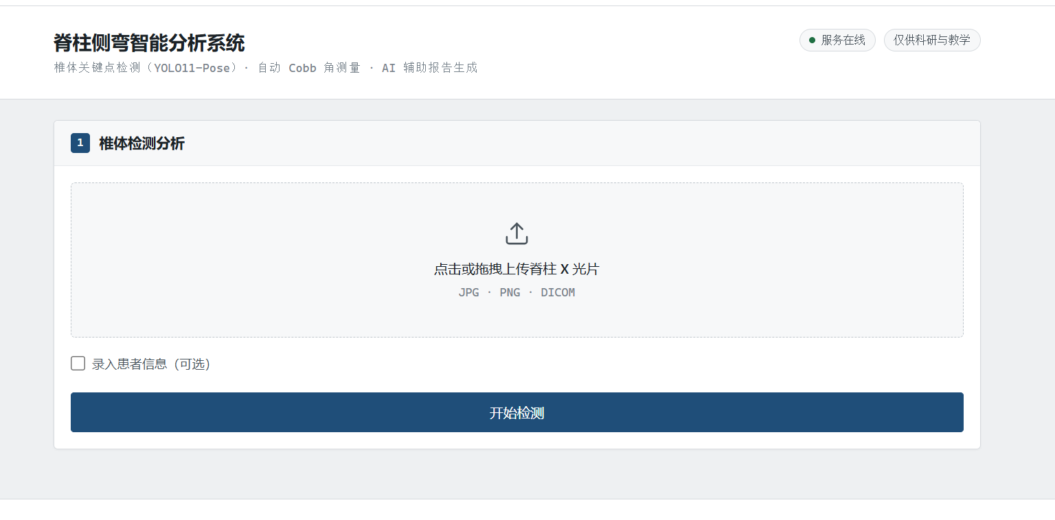 脊柱侧弯智能分析系统